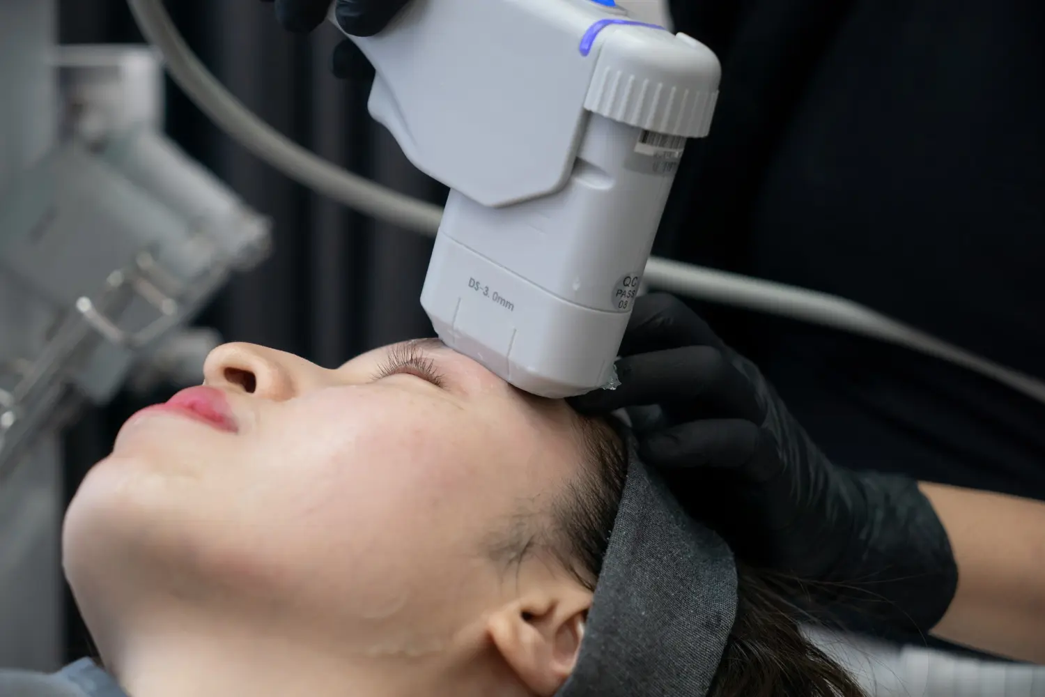 HIFU 3D von NOYA Aesthetics